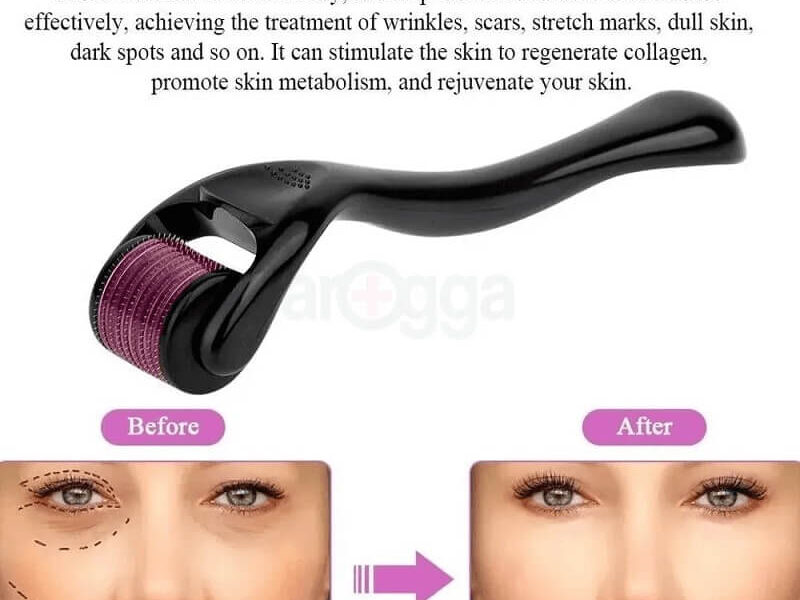 Derma Roller Micro Needle for Hair, Beard Growth and Facial Skin Therapy (1.00mm)