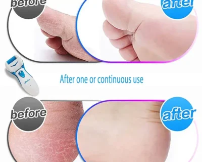 pedi-spin-rechargable4-1